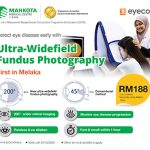 Langkah-Langkah Penting dalam Mencegah Penyakit Mata